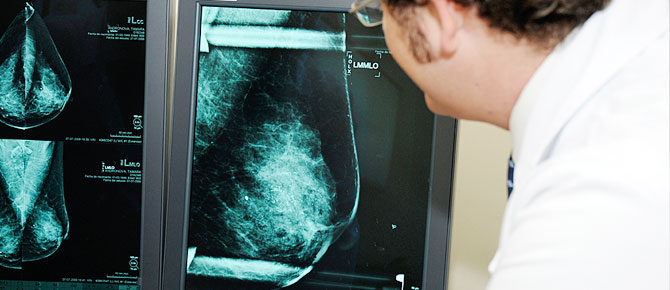 El cáncer de mama de hoy - Programas de Prevención (Screening)