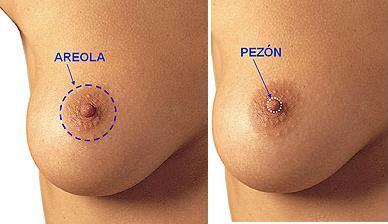 Esquema Disminucion de tamaño de areola - Cirugia de mama - Cpm Tejerina