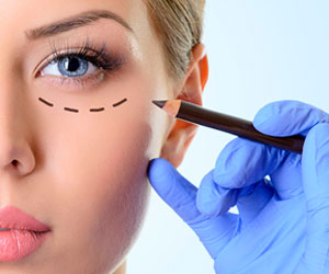 Blefaroplastia Párpados - Cirugia Facial - Cpm Tejerina