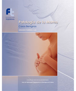 patología de la mama publicaciones Fundación Tejerina