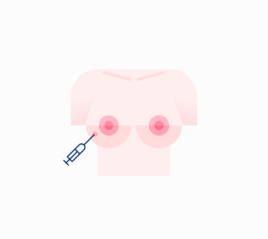 LIPO