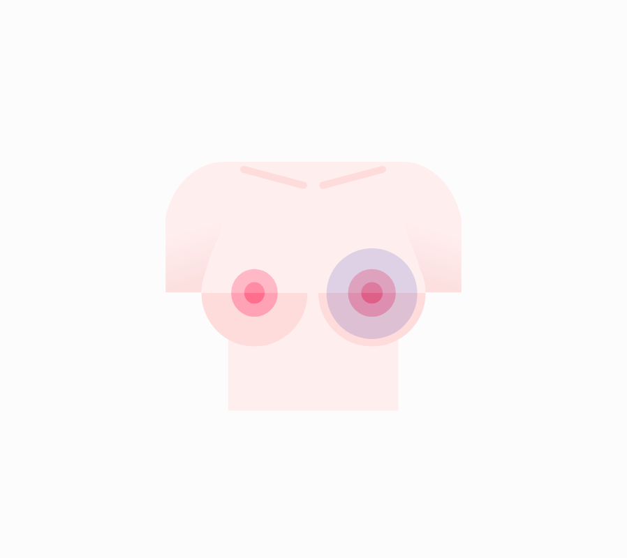 PROTESIS