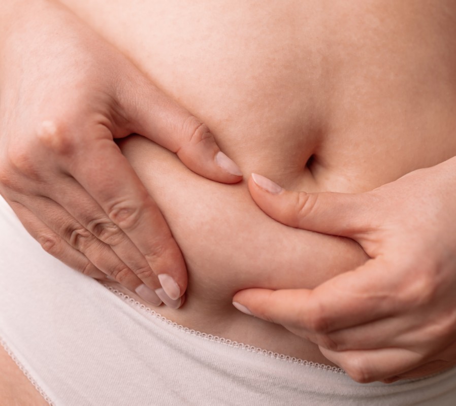 abdominoplastia