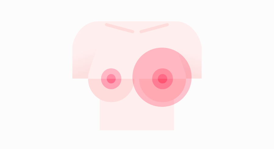 cirugia pecho 01
