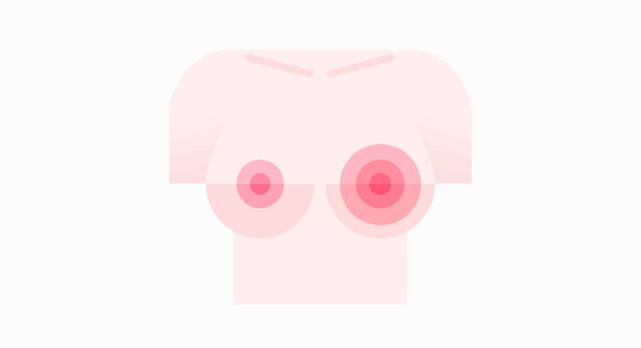 cirugia pecho 04