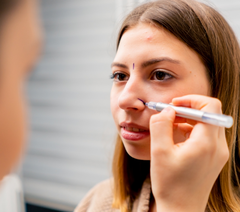 close up plastic surgeon makes marks on a patient 2024 02 15 16 44 44 utc (2)