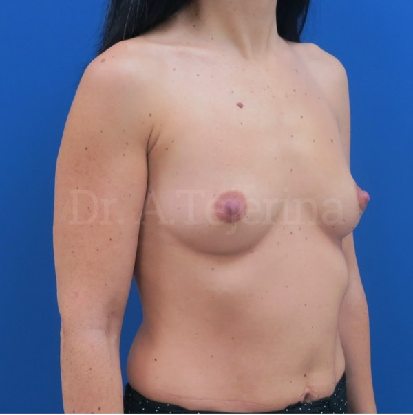 ANTES 2 – 21