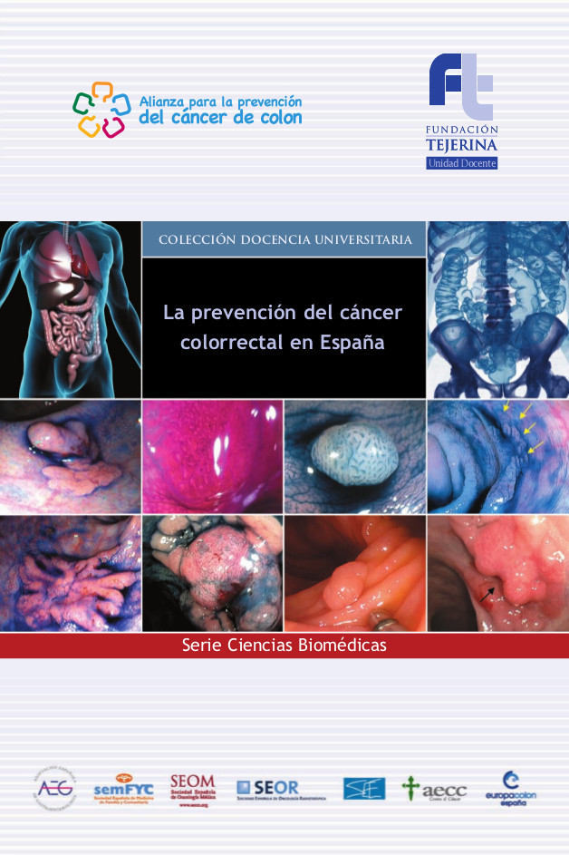 Monografia Cancer Colon webFT
